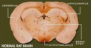 Cerveau de rat normal (Salford)